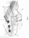Fig. 02 - Detachable controller device for musical instruments