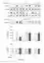 Fig. 06 - Aerosolized Dapsone as a Therapy for Inflammation of the Airway and Abnormal Mucociliary Transport