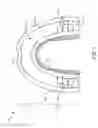 Fig. 02 - STABILIZING MOUTHPIECE WITH LOWER STABILIZING RIDGE