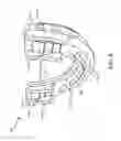 Fig. 09 - STABILIZING MOUTHPIECE WITH LOWER STABILIZING RIDGE