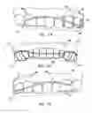 Fig. 07 - Reformable dental guard with reinforcing wire
