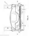 Fig. 16 - Method and apparatuses for screening