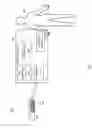 Fig. 02 - Infusion system housing medication scanner and user interface device displaying delivery data