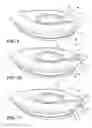 Fig. 08 - Locking ring