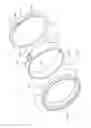 Fig. 02 - Molds and method of using the same for optical lenses