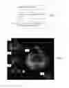 Fig. 02 - Animation for conveying spatial relationships in multi-planar reconstruction