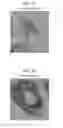 Fig. 02 - Fluorescent phospholipid ether compounds, compositions, and methods of use