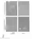 Fig. 02 - NORMALIZATION OF CULTURE OF CORNEAL ENDOTHELIAL CELLS