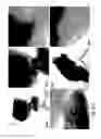 Fig. 09 - V2O5—LiBO2, V2O5—NiO—LiBO2 glasses and their composites obtained by nitrogen doping and reduced graphite oxide blending as cathode active materials
