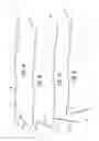 Fig. 02 - Root canal probe tool and method of removing a broken instrument fragment from a root canal