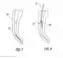 Fig. 09 - Root canal probe tool and method of removing a broken instrument fragment from a root canal