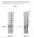 Fig. 02 - Outer membrane protein 18 as a diagnostic marker for campylobacter