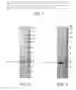 Fig. 02 - OUTER MEMBRANE PROTEIN 18 AS A DIAGNOSTIC MARKER FOR CAMPYLOBACTER