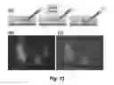 Fig. 11 - PHOTOTHERMAL SUBSTRATES FOR SELECTIVE TRANSFECTION OF CELLS