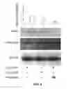 Fig. 07 - Method for treating diabetic retinopathy