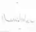 Fig. 02 - CRYSTALLINE N--5-chloro-4-(4-chloro-1-methyl-1H-pyrazol-5-yl)-2-thiophenecarboxamide hydrochloride