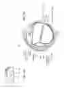 Fig. 02 - Intraocular pressure sensing devices and associated systems and methods