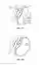 Fig. 05 - Intraocular pressure sensing devices and associated systems and methods