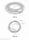 Fig. 07 - Intraocular pressure sensing devices and associated systems and methods