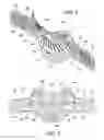 Fig. 05 - Cervical collar