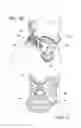 Fig. 06 - Cervical collar