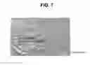 Fig. 09 - Activation of bone and cartilage formation