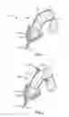 Fig. 02 - Male incontinence fluid capturing device and methods