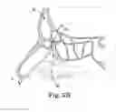 Fig. 07 - ELECTROSURGICAL DEVICE AND METHOD
