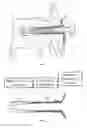 Fig. 02 - Universal anchor for bone fixation