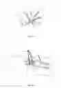 Fig. 09 - Universal anchor for bone fixation