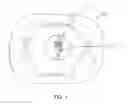 Fig. 02 - Ice Therapy System