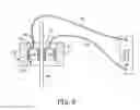 Fig. 07 - Feedthrough assembly for an implantable medical device