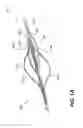 Fig. 02 - EXPANDABLE ELECTRODES AND METHODS FOR TREATING TISSUES
