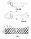 Fig. 02 - Stent designs and methods of manufacture