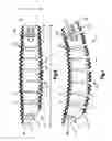 Fig. 06 - Flexible vertebral spacer