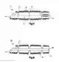 Fig. 11 - Flexible vertebral spacer