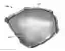 Fig. 01 - Patient-specific craniofacial implants