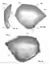 Fig. 04 - Patient-specific craniofacial implants