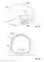 Fig. 06 - Patient-specific craniofacial implants
