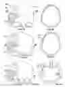 Fig. 09 - Patient-specific craniofacial implants