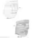 Fig. 03 - SYSTEM AND METHOD FOR FORMING A CUSTOM MEDICAL MASK FROM A THREE-DIMENSIONAL ELECTRONIC MODEL