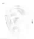 Fig. 02 - Helmet with shock absorbing inserts