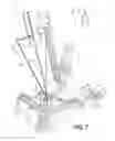 Fig. 06 - Laser cladding fabrication method
