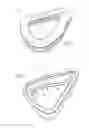 Fig. 02 - Cushion for patient interface