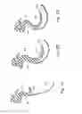 Fig. 48 - Cushion for patient interface
