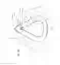 Fig. 53 - Cushion for patient interface