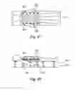 Fig. 37 - Device, system and method for immobilization of a human's body part
