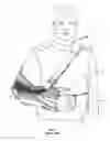 Fig. 02 - Arm immobilization device and associated methods