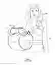 Fig. 04 - Arm immobilization device and associated methods