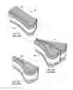 Fig. 08 - Arm immobilization device and associated methods